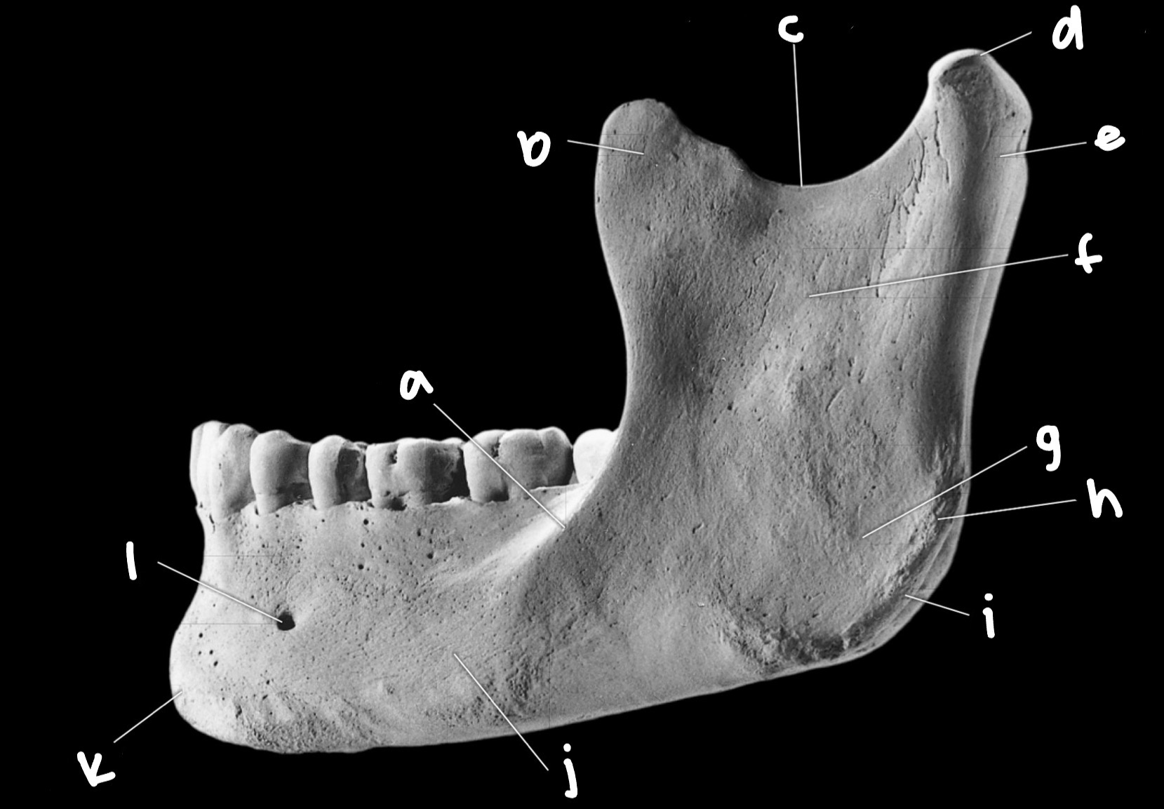 <p>Mandibular features slide 8</p>
