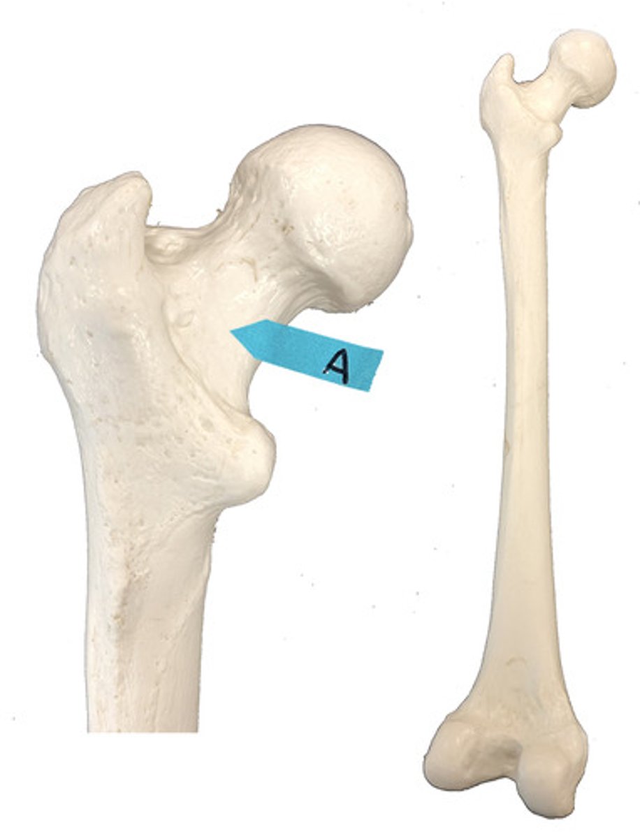 <p>Identify this bone marking.</p>