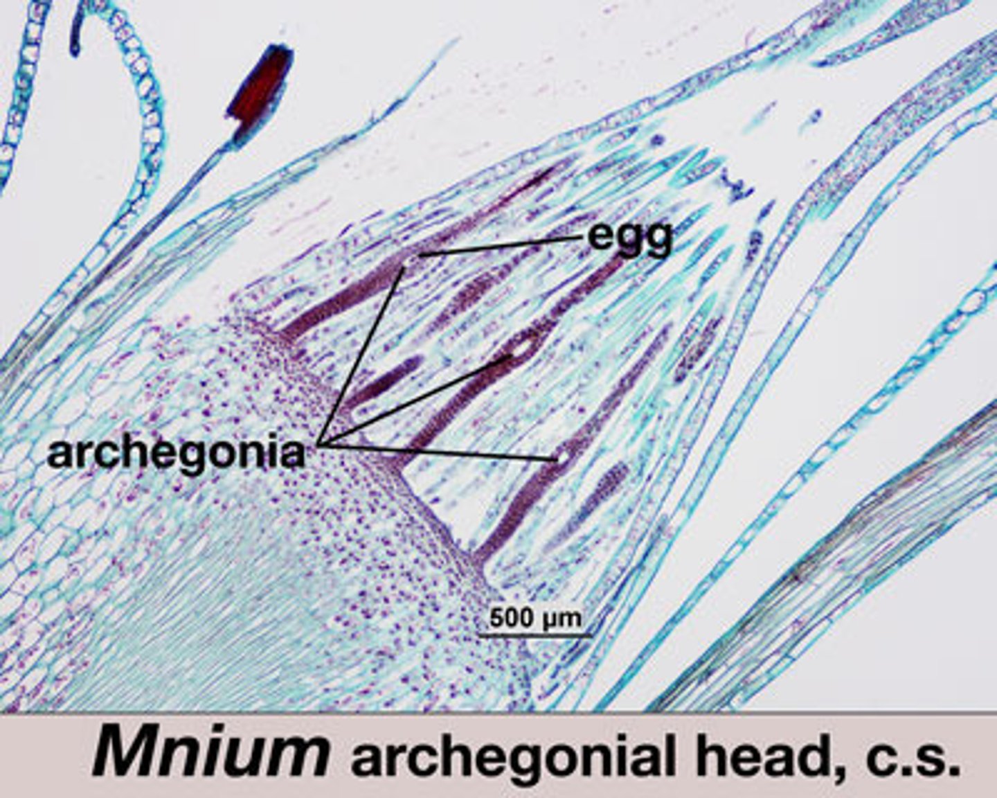 <p>neck, venter, calyptra, egg</p>