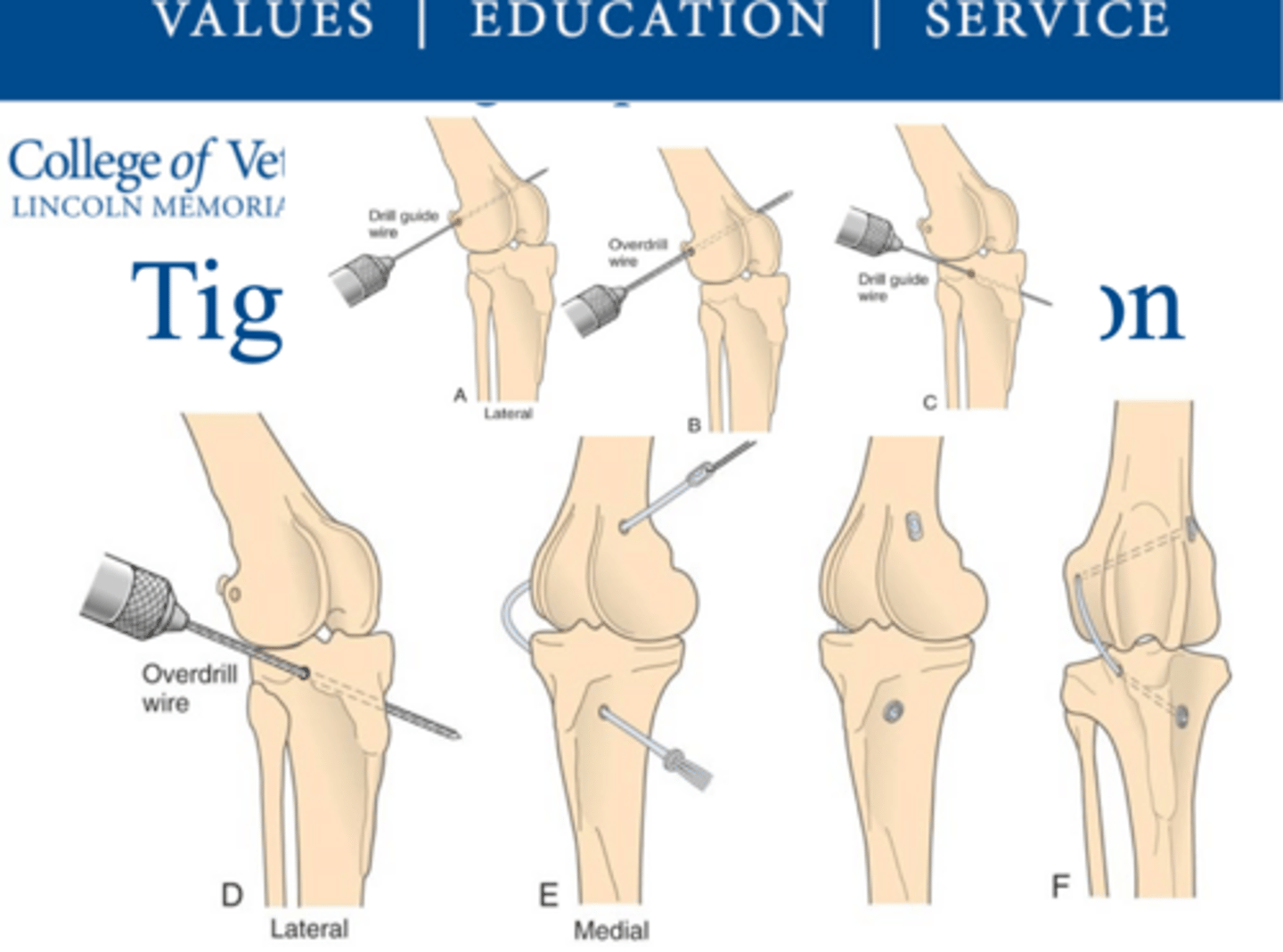 <p>what procedure is shown here</p>