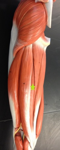 <p>Identify the Muscle.</p>