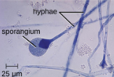 <p>Sporangia</p>