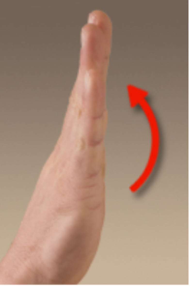 <p>metacarpophalangeal</p>