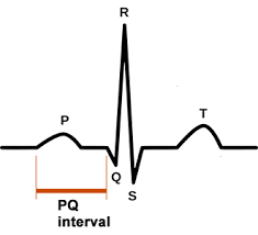 <p>Flat interval showing how fast the action potential is transmitted through the AV node (atrioventricular) from the atria to the ventricles. </p>
