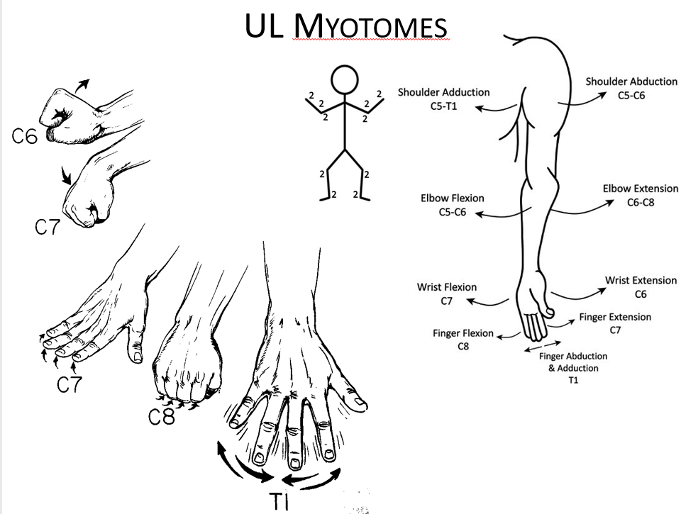 <p><span>•</span><span style="font-family: &quot;Bodoni MT&quot;">C7 nerve root: Exits between C6 and C7 foramina, innervates triceps, wrist flexors, and finger extensors, sensory distribution: middle finger, assessed with triceps reflex.</span></p><p></p><p><span>•</span><span style="font-family: &quot;Bodoni MT&quot;">C8 nerve root: Exits between C7 and T1 foramina, innervates interosseus muscles and finger flexors, sensory distribution: ring and little fingers and distal half of the forearm (ulnar side), no reflex.</span></p>