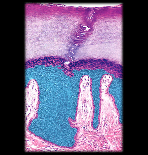 <p>What layer of the epidermis is highlighted</p>