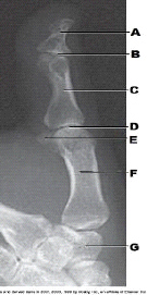 Which bone is labeled as letter A in the figure above?
