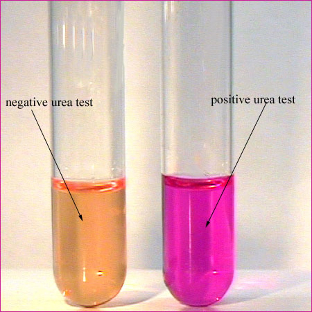 <p>Indicator = Phenol red</p><p>Pink color in 24 hr = rapid urease +</p><p>Orange/ yellow = -</p>