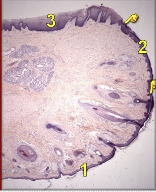 <p>Labio</p>