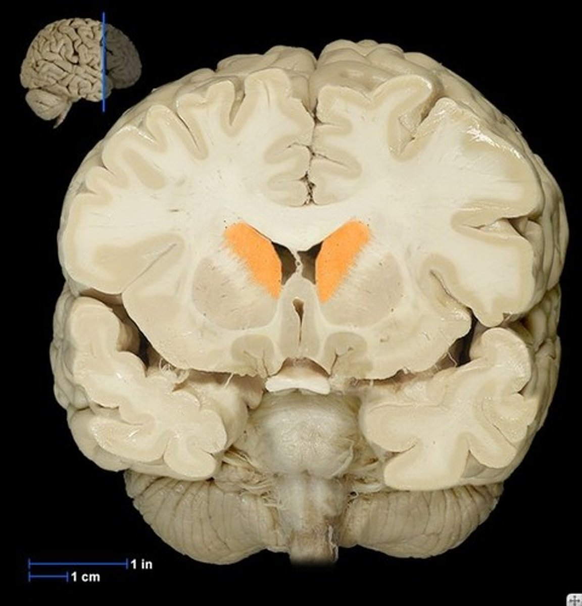 <p>cluster of cells</p>