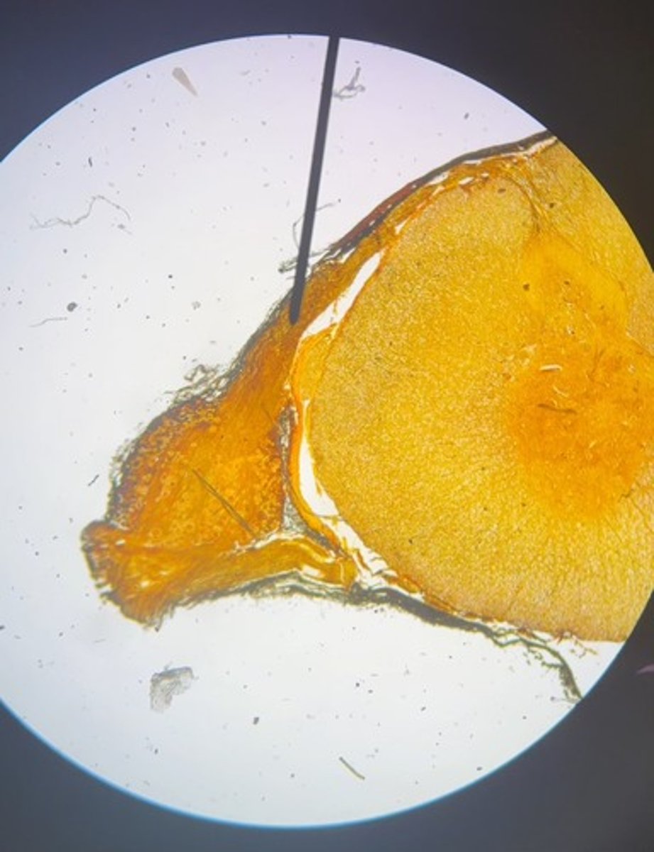 <p>1. What is the structure at the pointer?</p><p>2. What is the large round structure to the lower left of the pointer?</p>