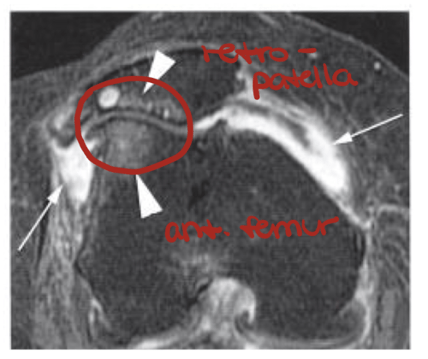 <p>Define the pathology.</p>