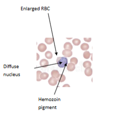 <p><span>What is the genus, species, and stage of this parasite?</span></p>