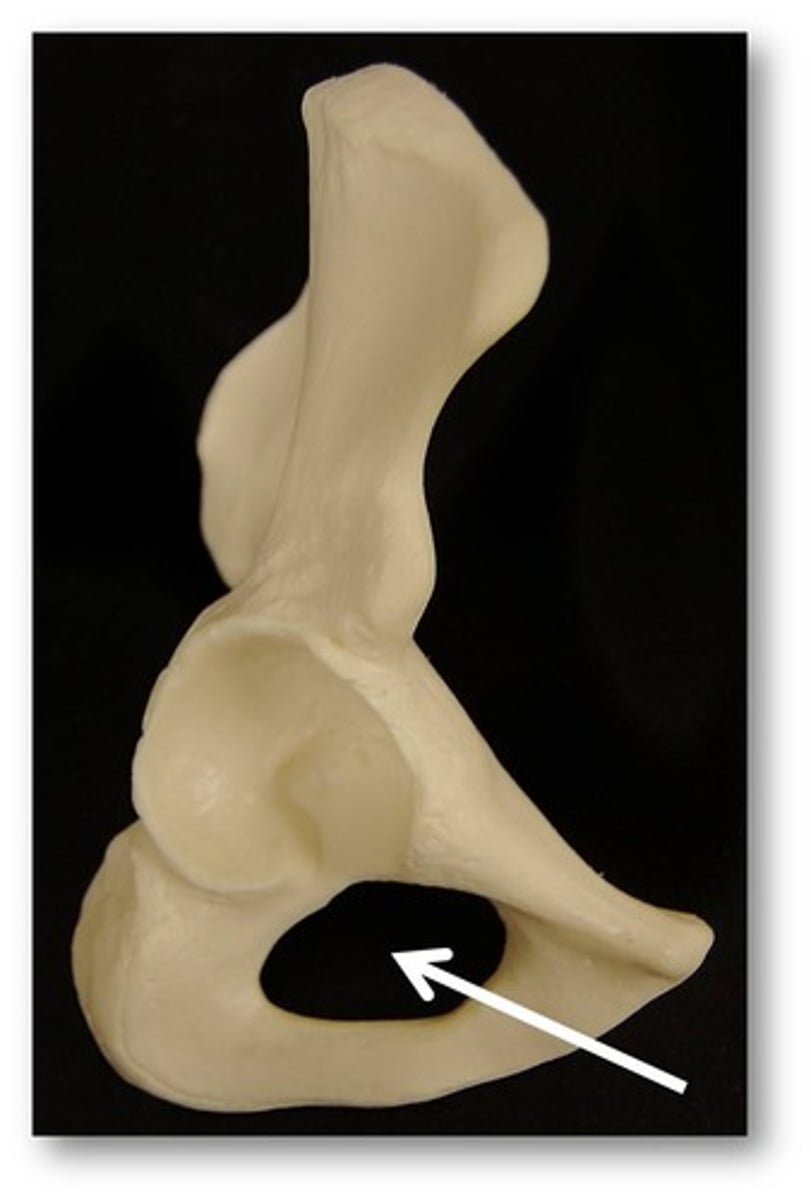 <p>Name this specific part of the pelvic bone.</p>