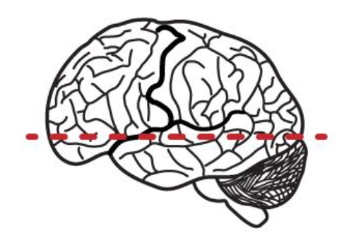 <p>What anatomical plane is this?</p>