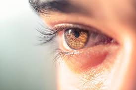 <p>What type of shot is this?</p>