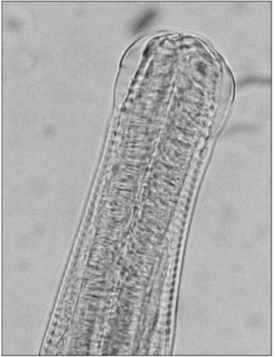 <p>What is this parasite? What characteristic/s did you use to identify it?</p>