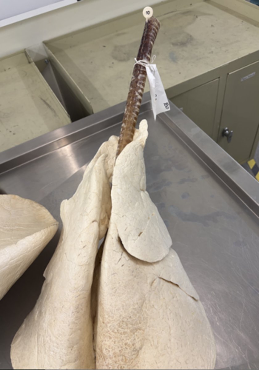 <p>10) a. Id the muscle found here</p><p>B. Classify it! (smooth, skeletal, cardiac)</p><p>C. Where is this muscle positioned relative to tracheal cartilage (external /internal)</p>