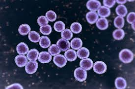 <p>What shape/arrangement is this bacteria?</p>
