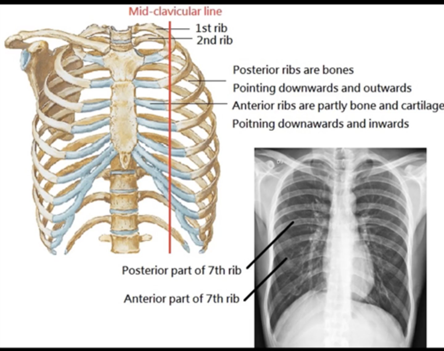 <p>(evaluating AP CXR) inspiration</p>