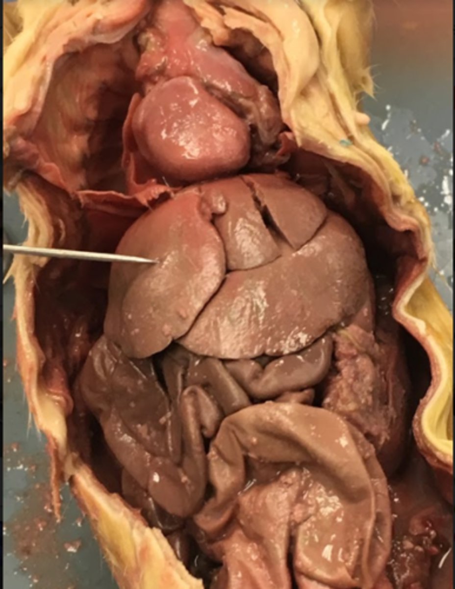 <p>liver: detox/metabolism</p>