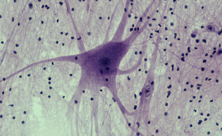 <p>Composed of neurons and nerve support cells</p>