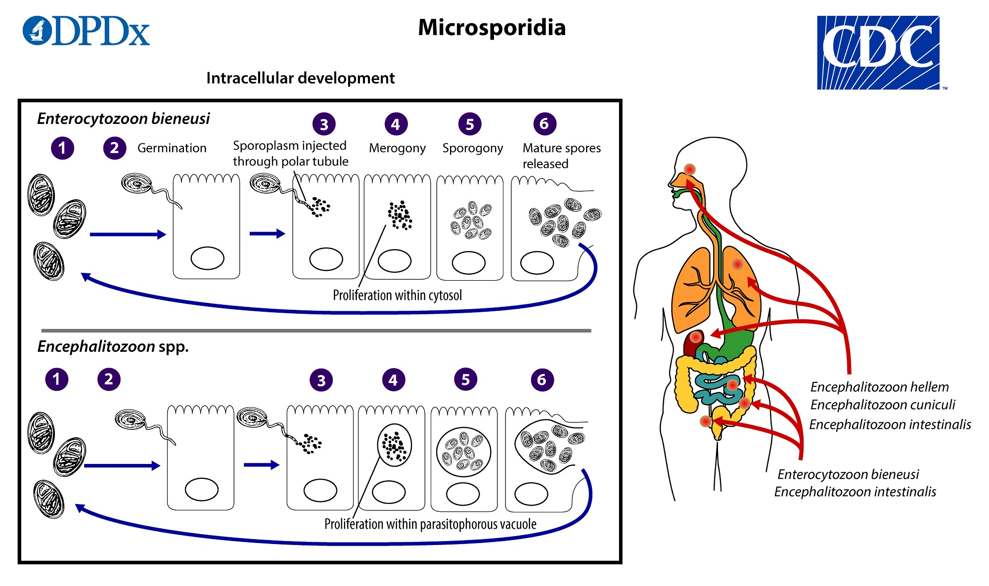 <p><strong>pathogenic in immunocompromised</strong> </p><ul><li><p><strong>Type</strong>: <strong>Obligate intracellular</strong>; <strong>1.5–2 μm</strong>, very small.</p></li><li><p><strong>Dx</strong>: <strong>“Impossible to find in feces”</strong> on routine O&amp;P; <strong>biopsy</strong> is the best specimen per deck.</p></li><li><p><strong>Bloody stool?</strong> No.</p></li></ul><p></p>