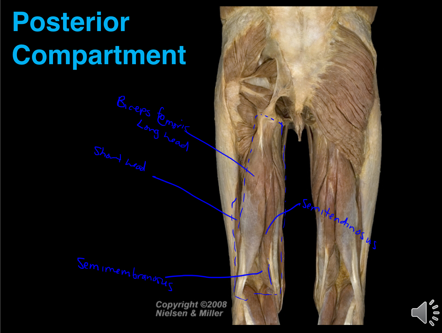 <ul><li><p>Biceps femoris</p></li><li><p>Semitendinosus</p></li><li><p>Semimembranosus</p></li></ul><p></p>