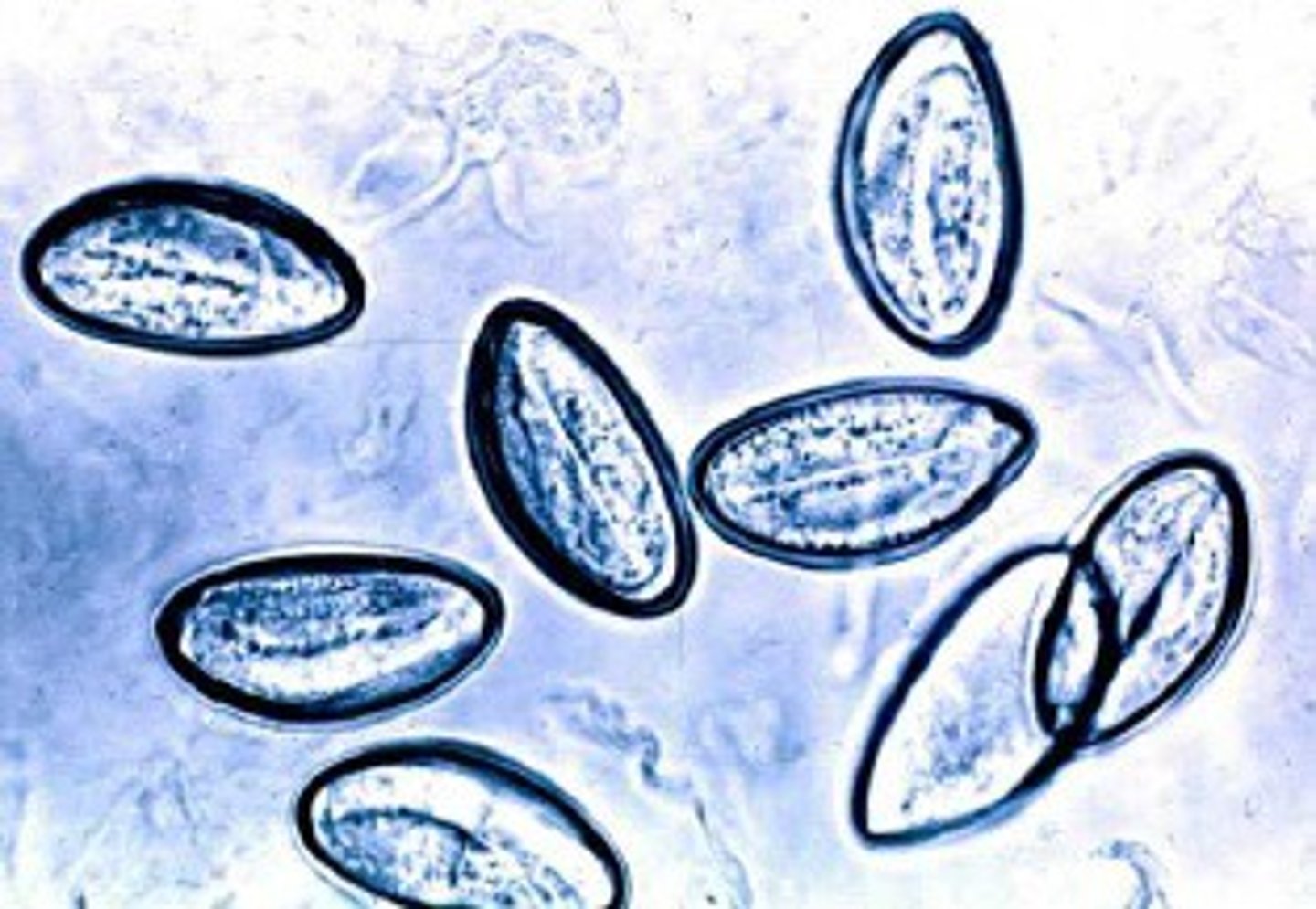 <p>The eggs seen here of this nematode usually are detected by the "cellophane tape" or "Scotch tape" test because the eggs are deposited around the perianal region and are not found in stool specimen. The ova of which roundworm is present?</p>