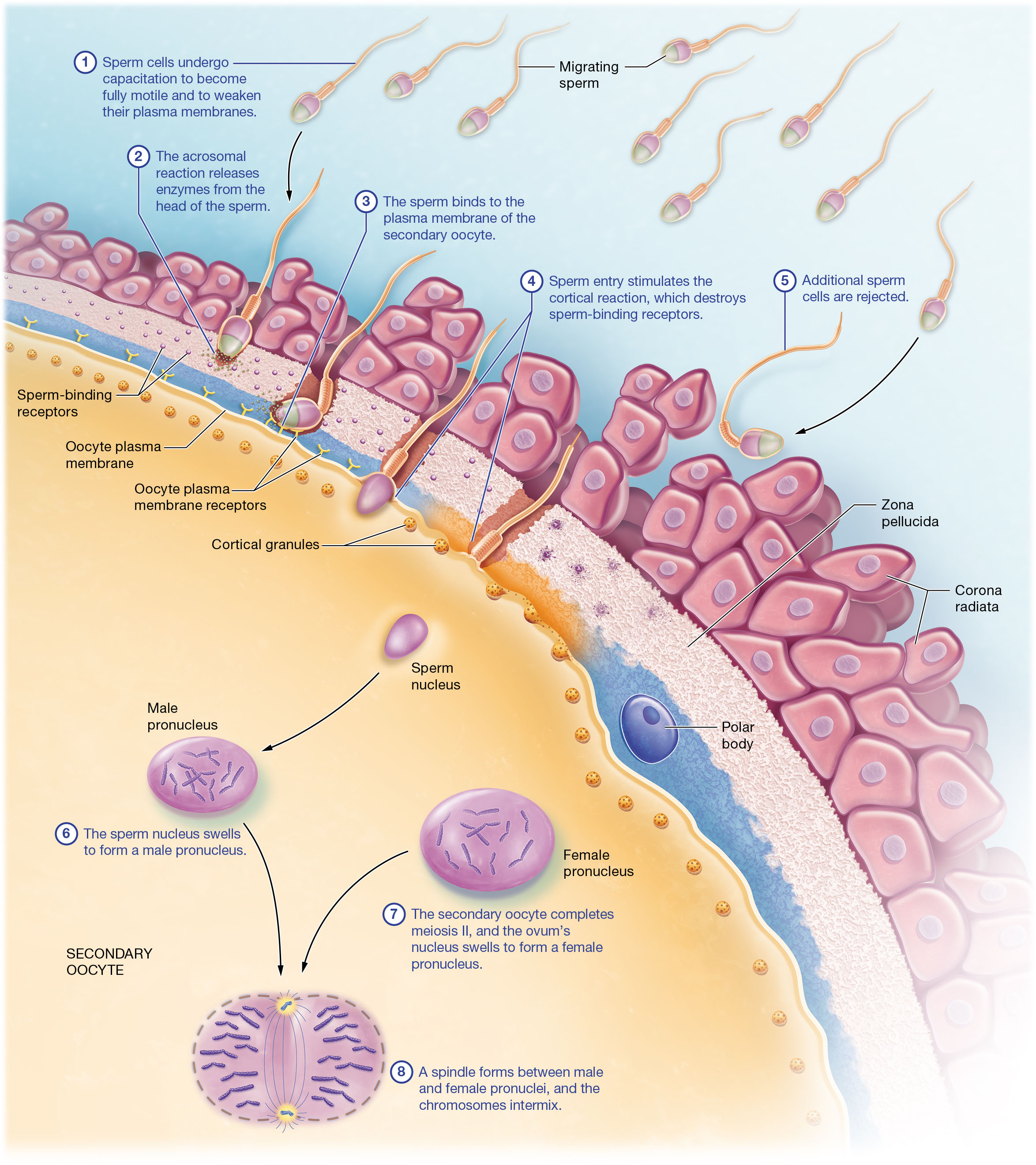 <p><strong>Acrosomal Reaction</strong></p><p>The acrosomal reaction is a crucial step in fertilization. It involves the release of enzymes from the acrosome, a membrane-enclosed sac at the head of the sperm. These enzymes, including hyaluronidase and acrosin, help the sperm penetrate the protective layers surrounding the secondary oocyte, such as the corona radiata and zona pellucida. This reaction is triggered when the sperm binds to receptors in the zona pellucida, allowing calcium ions to enter the sperm, which initiates the release of acrosomal enzymes. Multiple sperm are needed to release enough enzymes to penetrate these layers, highlighting the importance of a sufficient sperm count for successful fertilization.</p><p><strong>Cortical Reaction</strong></p><p>The cortical reaction occurs after a sperm successfully enters the secondary oocyte. This reaction involves the release of enzymes from cortical granules within the oocyte, which destroy sperm-binding receptors on the oocyte's surface. This process prevents additional sperm from entering, thus avoiding polyspermy, which would result in a triploid zygote and is fatal. The cortical reaction ensures that only one sperm fertilizes the oocyte, allowing normal development to proceed.</p>