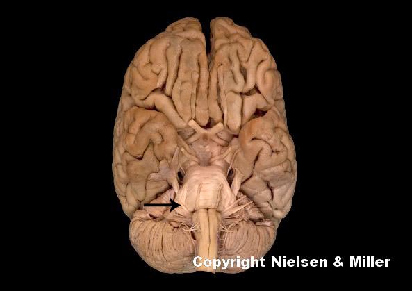 <p>what is indicated nerve</p>
