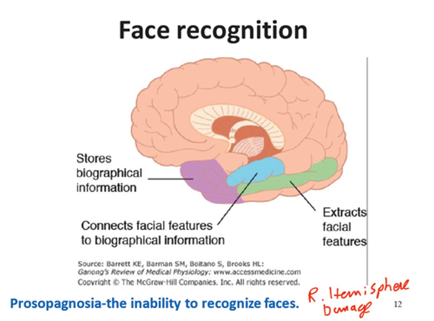<p>inability to recognize faces (face blindness)</p>