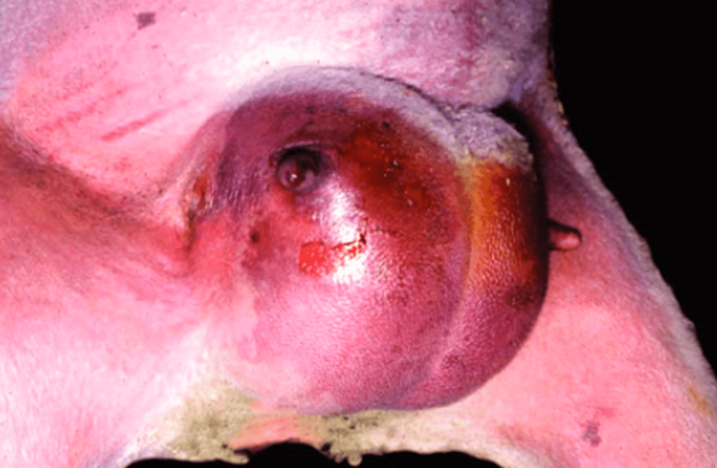 <p>What type of necrosis is being shown in this image?</p>