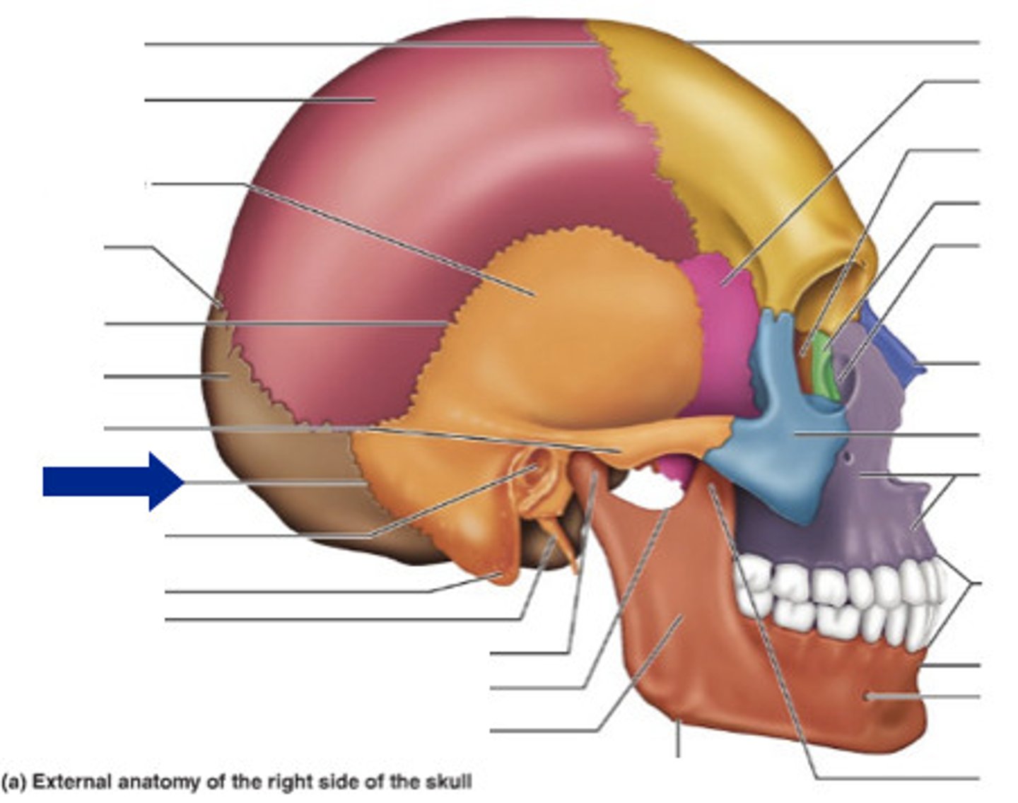 <p>The suture between the occipital and the temporal bones; a continuation of the lamboid suture.</p>