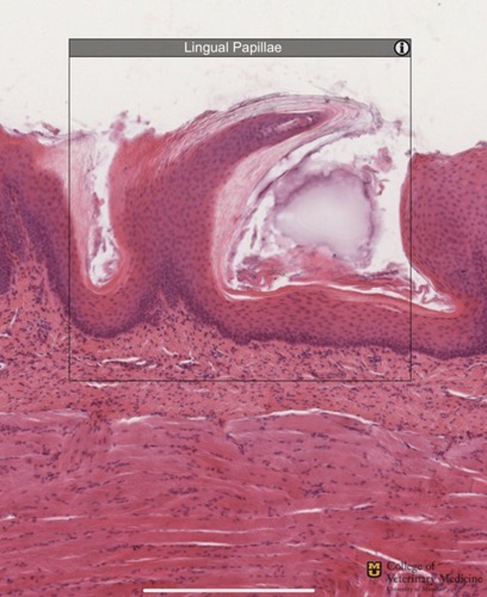 <p>What epithelium type is shown?</p>