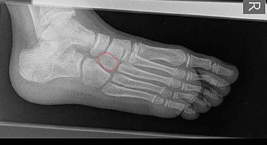 <p>What is this bone?</p>