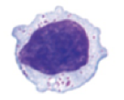 large lymphocyte 