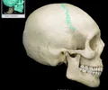 <p>the suture between the parietal and frontal bones of the skull</p>