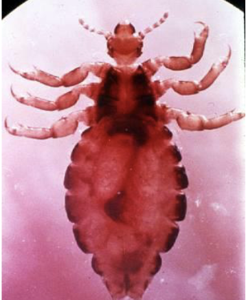 <p>lice</p><ul><li><p>parasites birds and mammals</p></li><li><p>modified tarsi&nbsp;</p></li></ul><p></p>