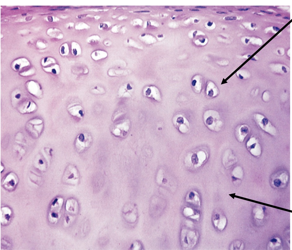 <p>A type of cartilage characterized by a translucent matrix, providing stiff but flexible support, found in various locations such as between ribs and sternum.</p>