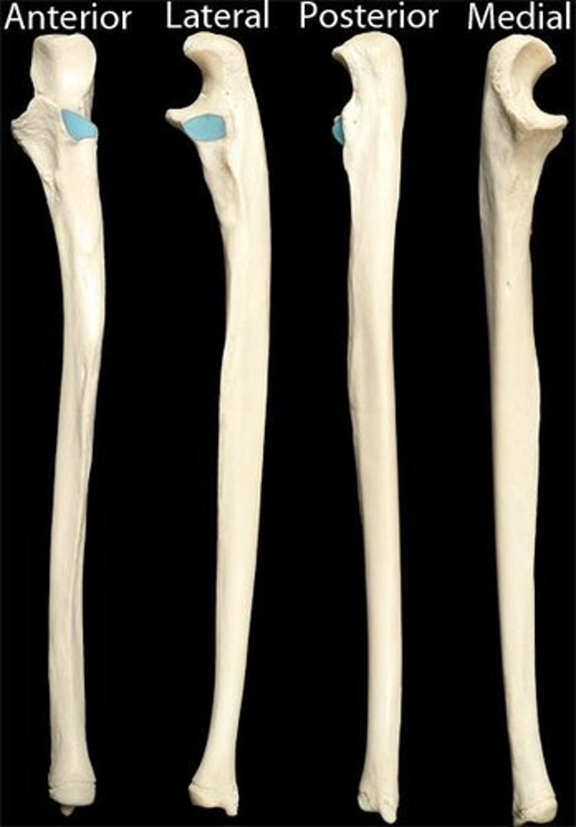 <p>articulates with head of radius</p>