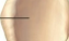 <ul><li><p>A type of opening</p></li><li><p>site of muscle attachment</p></li><li><p>Ex: supraspinous fossa</p></li></ul><p></p>