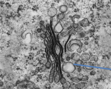 <p>membrane bound sac moved within cells by cytoskeleton, transports materials around cells</p>