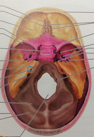 <p>What is this part of skull?</p>