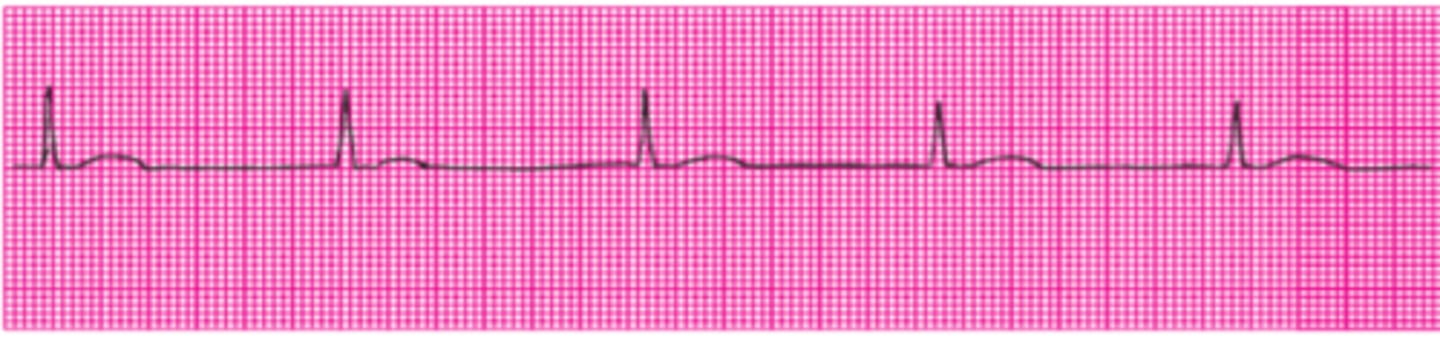 <p>Name this rhythm.</p>