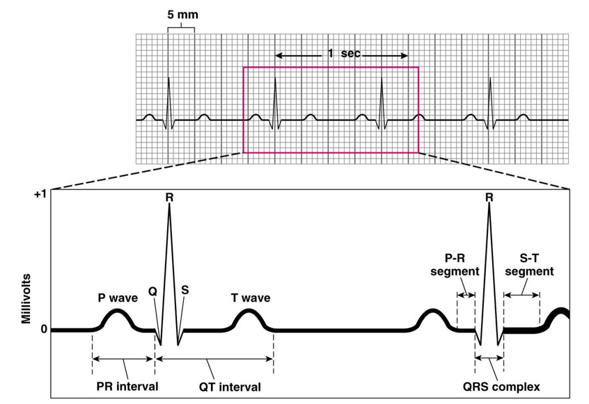 <p><u>Waves in ECG</u></p><ul><li><p><strong>P wave</strong>: atria depolarize</p></li><li><p><strong>QRS complex</strong>: ventricles depolarize, atria repolarize</p></li><li><p><strong>T wave</strong>: ventricles repolarize</p></li></ul>