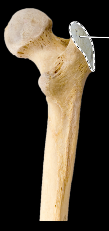 <p>Femur, posterior view, right side, proximal </p>