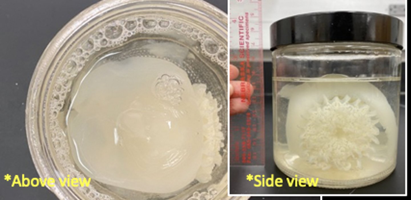 <p>Phylum: Cnidaria</p><p>Class: Scyphozoa</p>