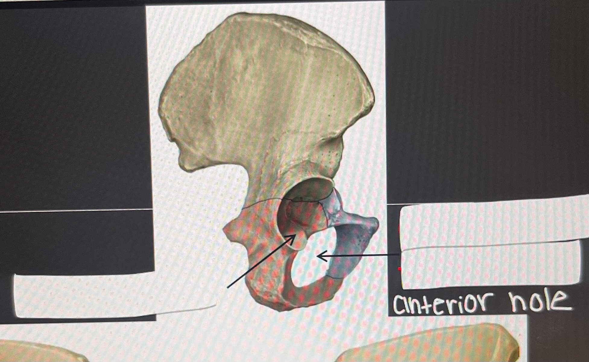 <p>term for the</p><p>hip socket</p><p>cut out in pelvis</p>