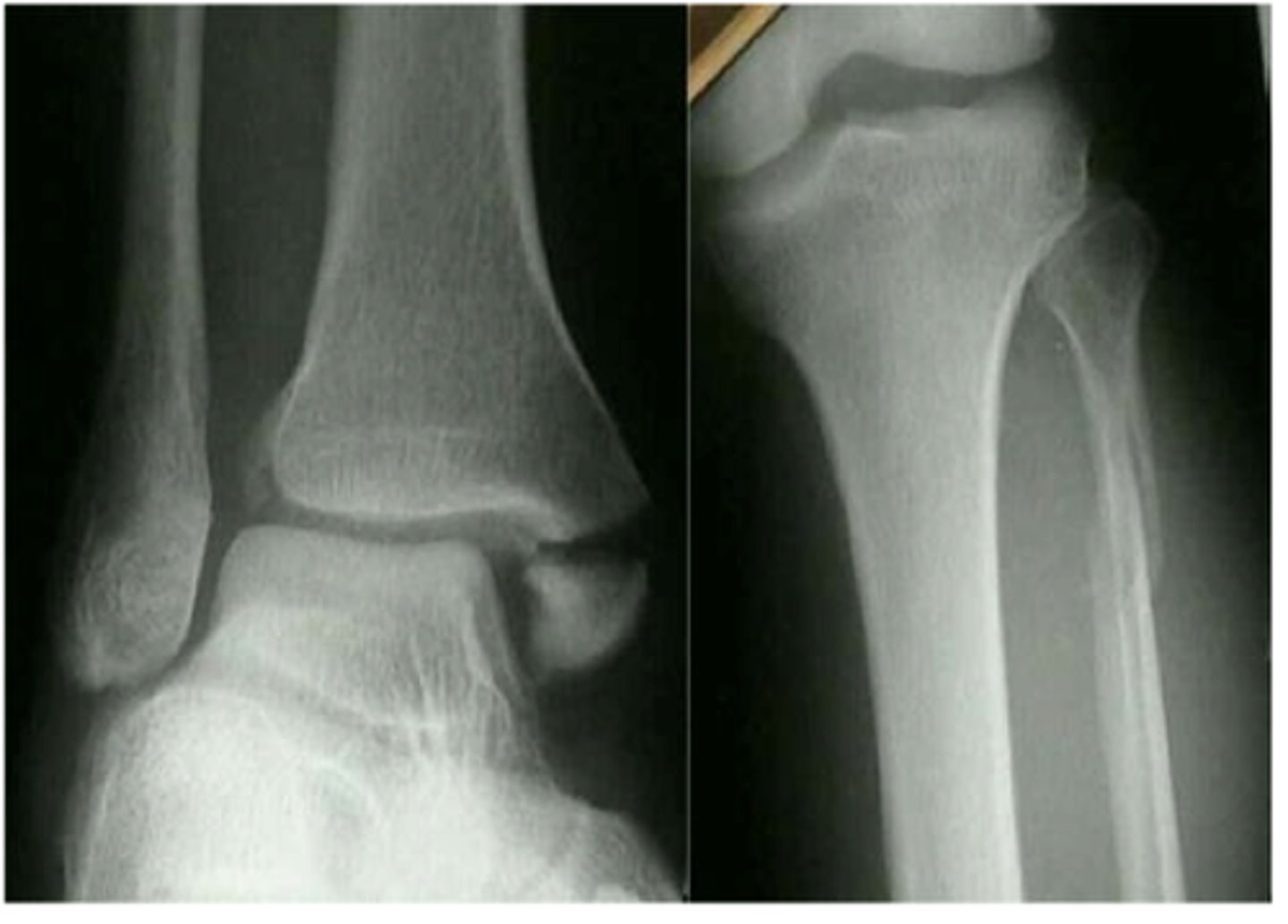 <p>Pic on The Right</p>